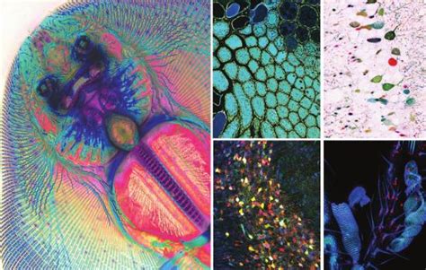  Gestionella! Een Microscopisch Meesterwerk van Vormen en Functies